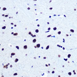 Serum Response Factor (SRF) Antibody