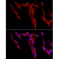 WD Repeat-Containing Protein 6 (WDR6) Antibody