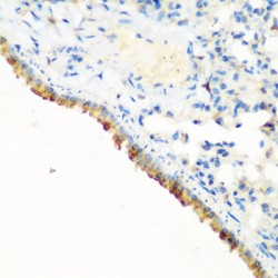 E3 Ubiquitin-Protein Ligase CBL (CBL) Antibody
