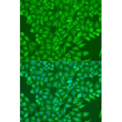 E3 Ubiquitin-Protein Ligase CBL (CBL) Antibody