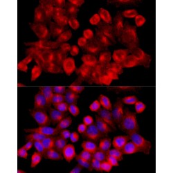 Clathrin Heavy Chain (CLTC) Antibody