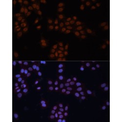 General Transcription Factor III (GTF2I) Antibody