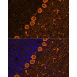 Protein Kinase C Gamma (PRKCG) Antibody