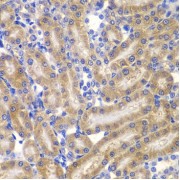 abx123067