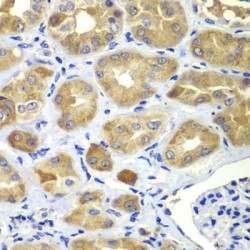 SHC-Transforming Protein 1 (SHC1) Antibody