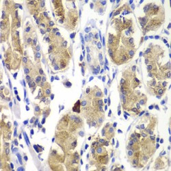 SHC-Transforming Protein 1 (SHC1) Antibody