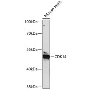 Western blot analysis of extracts of Mouse testis using CDK14 Antibody (1/1000 dilution).