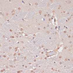 P53-Induced Death Domain Protein 1 (LRDD) Antibody