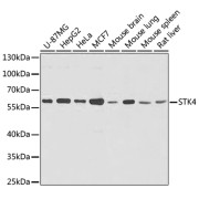 Western blot analysis of extracts of various cells using STK4 Antibody (1/1000 dilution).