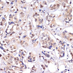 Serine/Threonine Kinase 4 (STK4) Antibody
