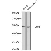 Western blot analysis of extracts of various cell lines using TGFB2 Antibody (1/1000 dilution).