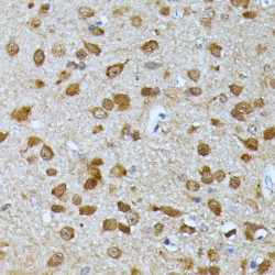 Polyubiquitin-C (UBC) Antibody