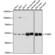 Western blot analysis of extracts of various cell lines using TUBB3 Antibody (1/1000 dilution).