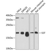 Western blot analysis of extracts of various cell lines using SST Antibody (1/1000 dilution).