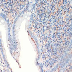 Somatostatin (SST) Antibody
