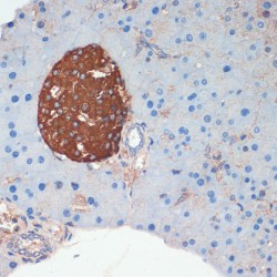 Somatostatin (SST) Antibody