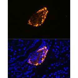 Somatostatin (SST) Antibody