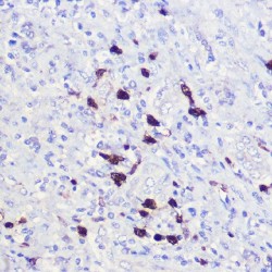 Cyclin Dependent Kinase Inhibitor 1A (CDKN1A) Antibody