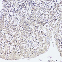 Twist-Related Protein 1 (TWIST1) Antibody