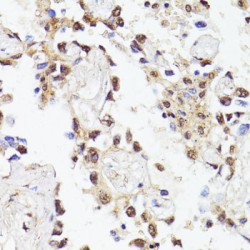 Twist-Related Protein 1 (TWIST1) Antibody