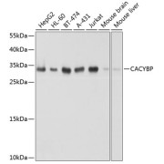 Western blot analysis of extracts of various cell lines using CACYBP Antibody (1/1000 dilution).