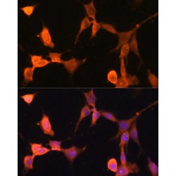 Calcyclin Binding Protein (CACYBP) Antibody