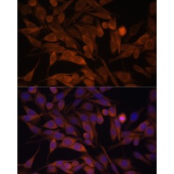 Calcyclin Binding Protein (CACYBP) Antibody