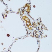 Immunohistochemistry of paraffin-embedded Human lung using C1QC Antibody (1/100 dilution, 40x lens).