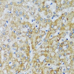Complement Component 1q Subcomponent C (C1qC) Antibody