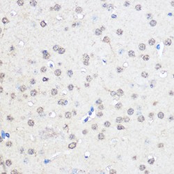 CCR4-NOT Transcription Complex Subunit 7 (CNOT7) Antibody