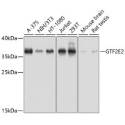 Western blot analysis of extracts of various cell lines using GTF2E2 Antibody (1/1000 dilution).
