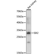 Western blot analysis of extracts of Rat kidney using SIX2 Antibody (1/1000 dilution).