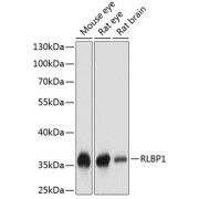 Western blot analysis of extracts of various cell lines using RLBP1 Antibody (1/1000 dilution).