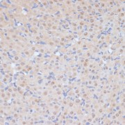 Immunohistochemistry of paraffin-embedded Rat ovary using CDK9 Antibody (1/100 dilution, 40x lens).