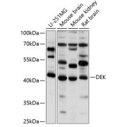 Western blot analysis of extracts of various cell lines using DEK Antibody (1/1000 dilution).