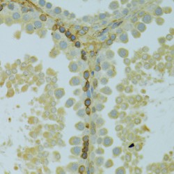 Potassium Inwardly Rectifying Channel Subfamily J, Member 1 (KCNJ1) Antibody