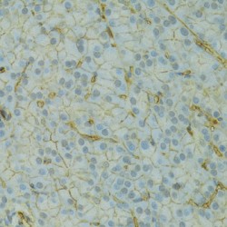 Potassium Inwardly Rectifying Channel Subfamily J, Member 1 (KCNJ1) Antibody