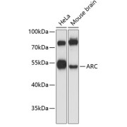 Western blot analysis of extracts of various cell lines using ARC Antibody (1/3000 dilution).