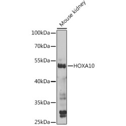 Homeobox Protein Hox-A10 (HOXA10) Antibody