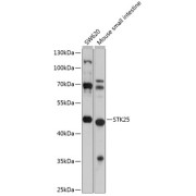 Western blot analysis of extracts of various cell lines using STK25 Antibody (1/1000 dilution).