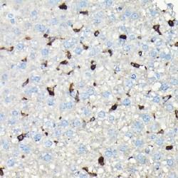 Coronin 1A (CORO1A) Antibody