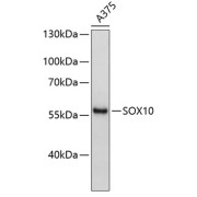 Western blot analysis of extracts of A-375 cells using SOX10 Antibody.