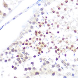 Nucleoporin 50 (NUP50) Antibody