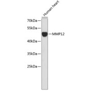 Western blot analysis of extracts of Human heart using MMP12 Antibody.