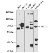 Western blot analysis of extracts of various cell lines using NMT1 Antibody (1/1000 dilution).