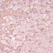 Immunohistochemistry of paraffin-embedded Rat adrenal gland using CYP11B2 Antibody (1/100 dilution, 40x lens).