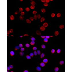 Cytochrome P450 11B2 (CYP11B2) Antibody