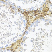 abx123921