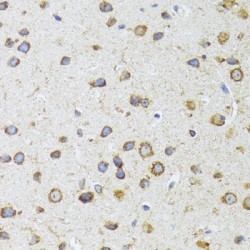 Apoptosis-Inducing Factor 3 (AIFM3) Antibody