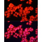 Immunofluorescence analysis of HeLa cells using ARAF Antibody (1/100 dilution). Blue: DAPI for nuclear staining.
